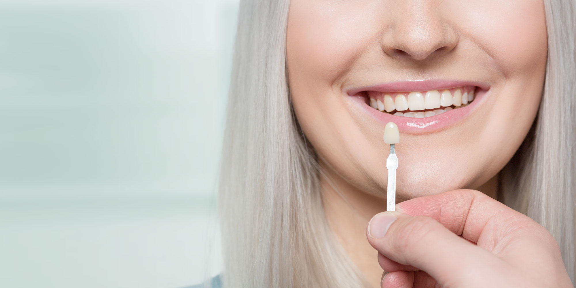 veneers in newton, ma.