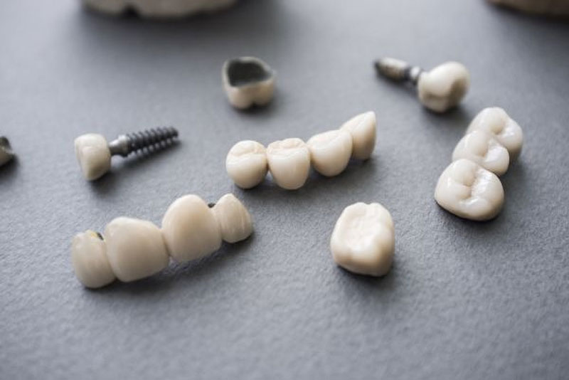 Dental Crowns & Bridges On A Table