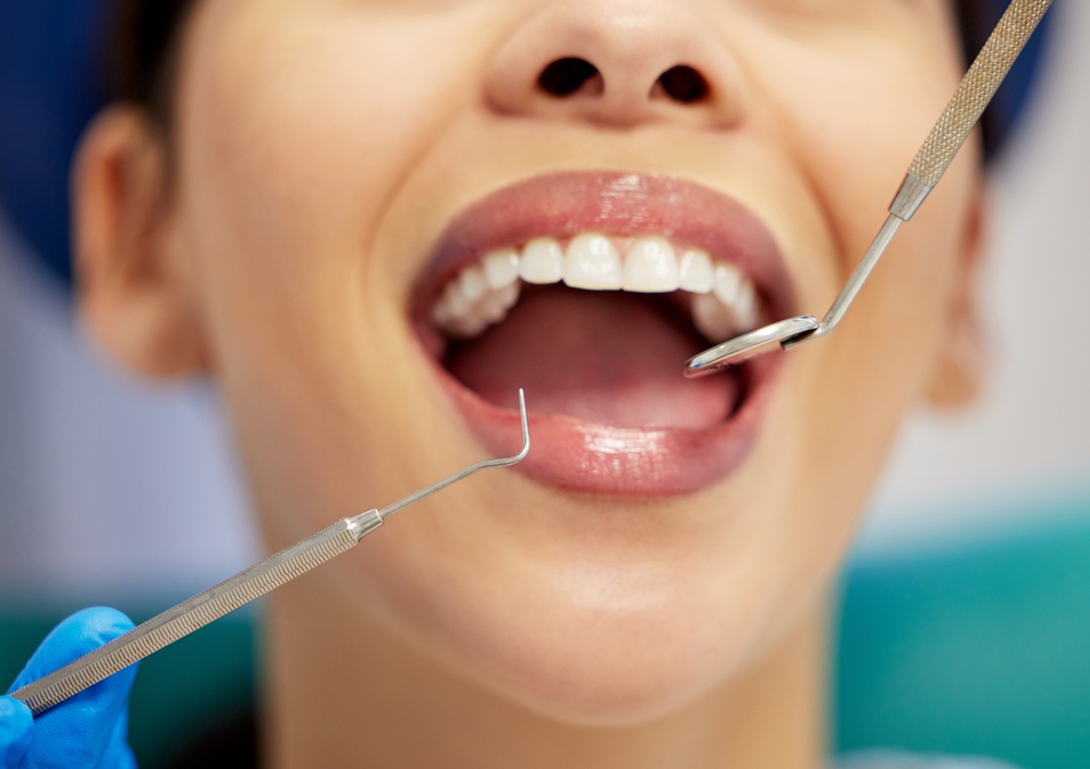 A person with a brilliant smile is showing off their perfect porcelain veneers. The background will be blurred to keep focus on the smile. No text on the image.
