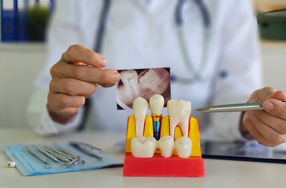 Close up of a smiling woman in a dental chair talking with a dentist about the cost of dental implants. No text on the image.