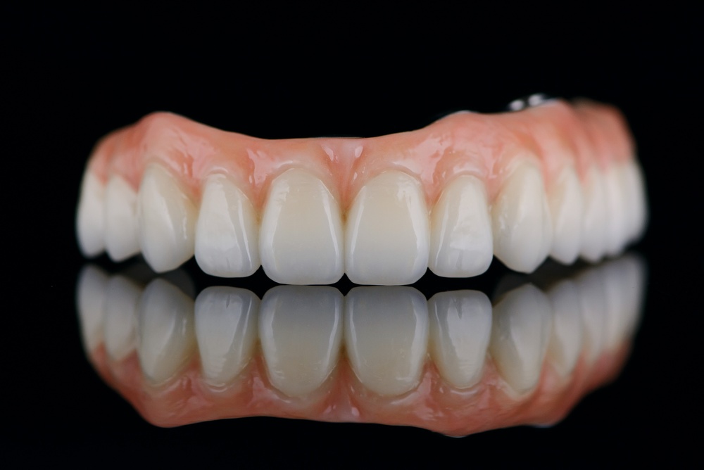 A caring teeth implant specialist is consulting with a patient about dental implant options, using advanced 3D imaging technology. The specialist is pointing to the scan, explaining the procedure. No text on the image.